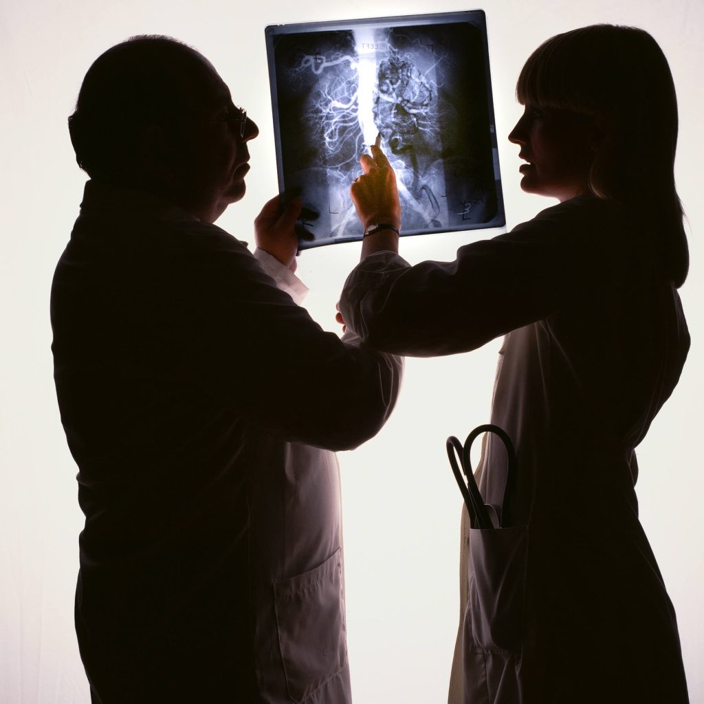 doctors examining x-ray on light board